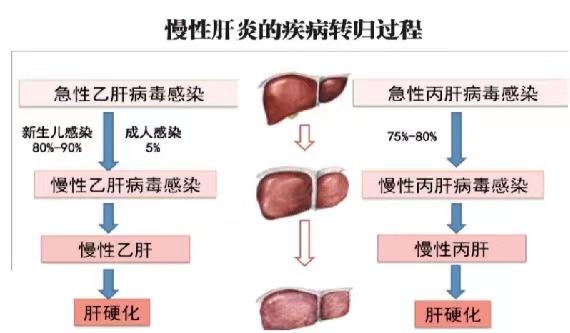 【健康科普】世界肝炎日——堅持早預防,加強檢測發(fā)現,規(guī)范抗病毒治療